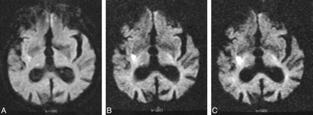 fig 3.