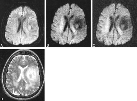 fig 7.