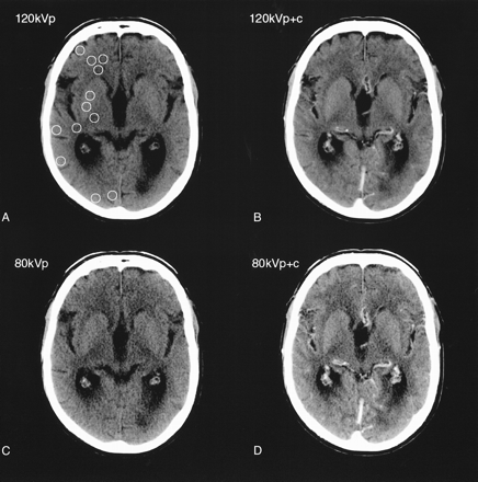 fig 1.