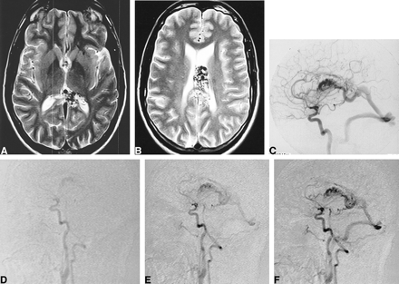 fig 2.