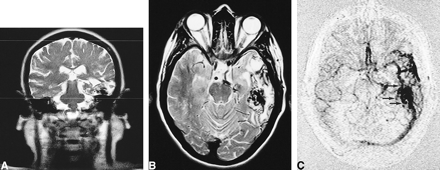 fig 4.