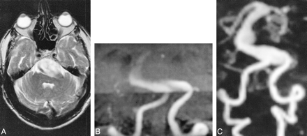 fig 2.