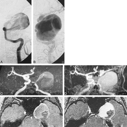 fig 3.