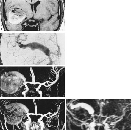 fig 4.