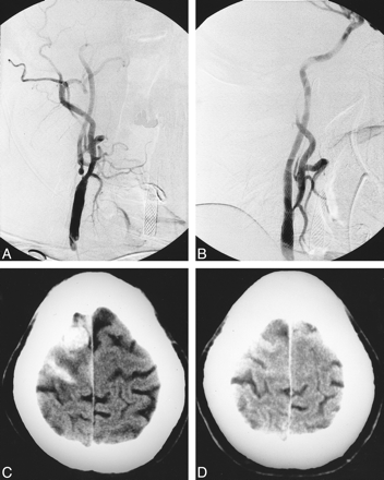 fig 2.