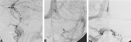 fig 2.