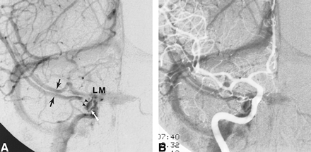 fig 4.