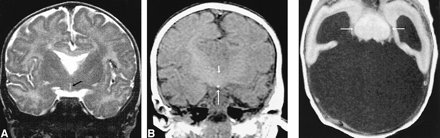 fig 2.