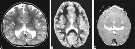 fig 4.
