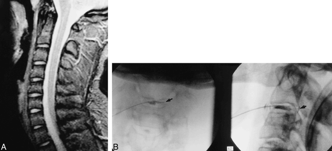 fig 1.
