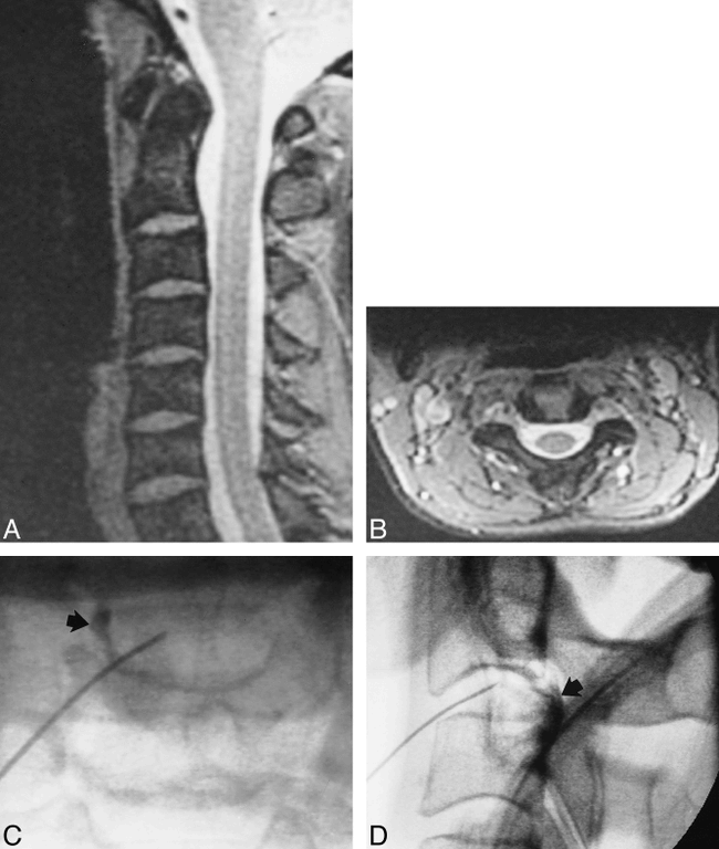 fig 2.