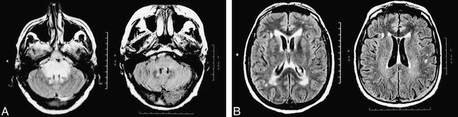 fig 2.