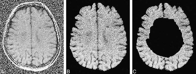 fig 1.