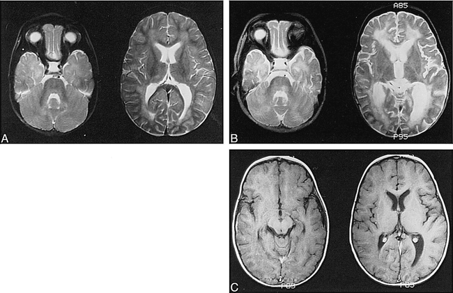 FIG 1.