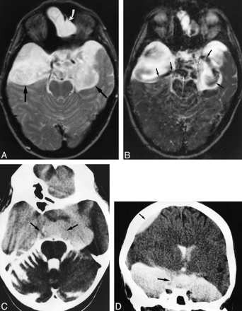 fig 4.