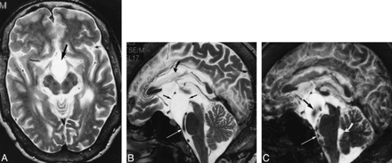 fig 7.
