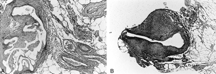 fig 6.