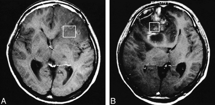 fig 3.