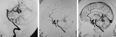 fig 2.