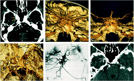 fig 3.