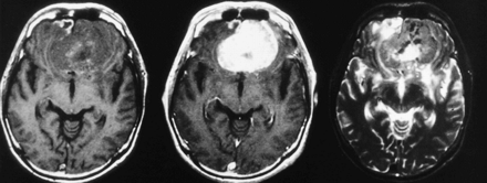 fig 1.