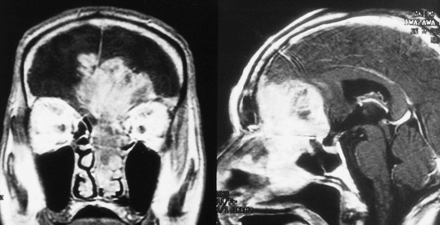 fig 2.