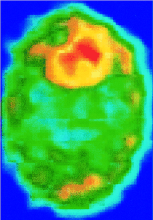 fig 3.