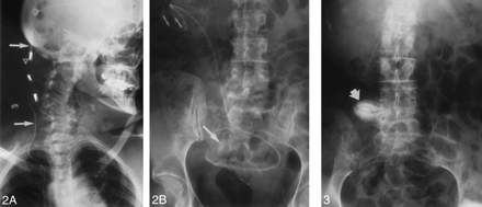 fig 3.