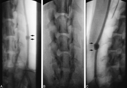 fig 2.