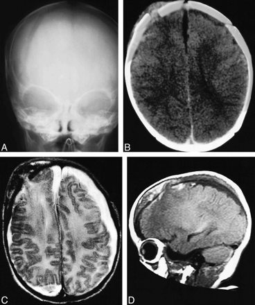 fig 1.