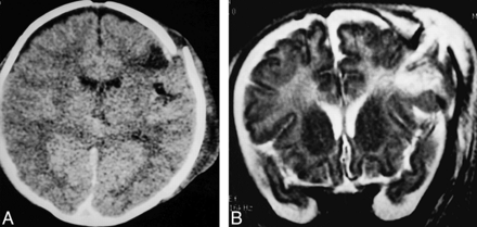 fig 2.