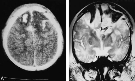 fig 3.