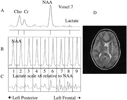 fig 3.