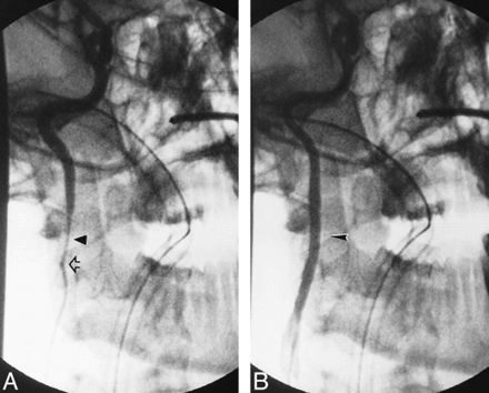 fig 1.