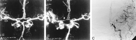 fig 2.
