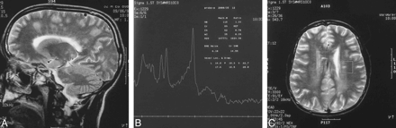 fig 1.