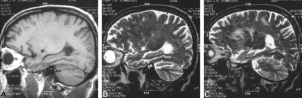 fig 2.