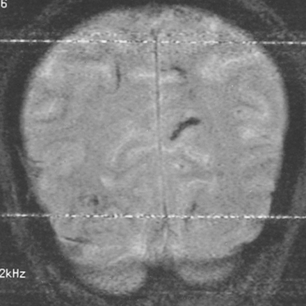 fig 3.