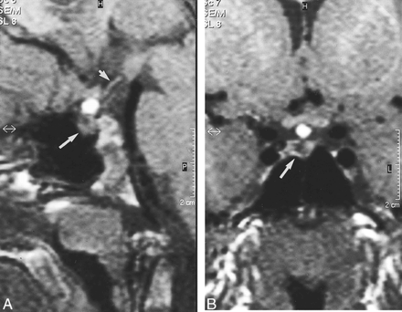 fig 1.
