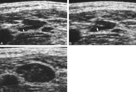 fig 3.