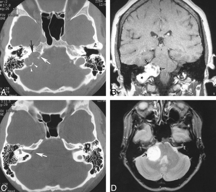 fig 1.