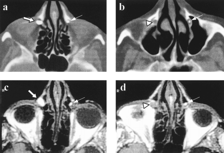 fig 2.