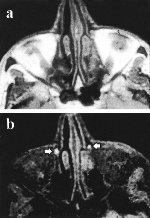 fig 4.