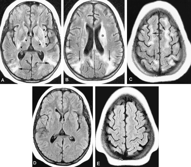 fig 1.