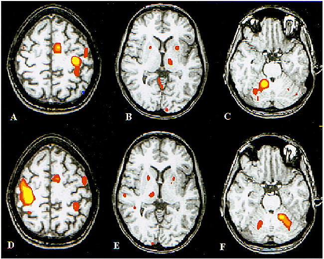 fig 2.