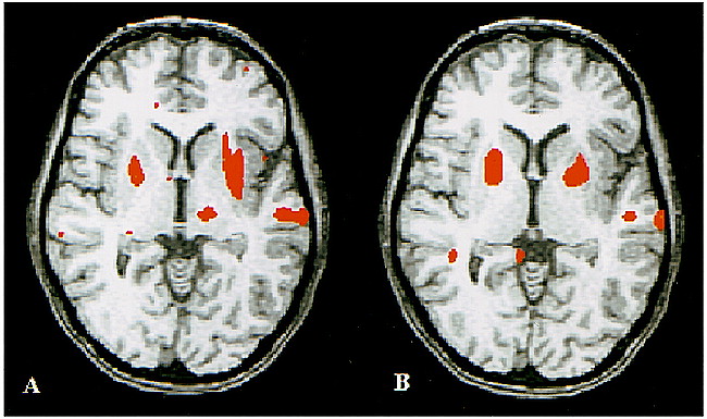 fig 3.