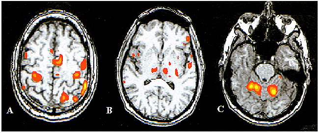fig 4.