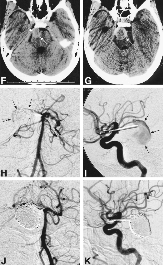 fig 1.