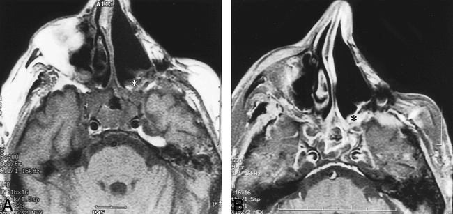fig 2.