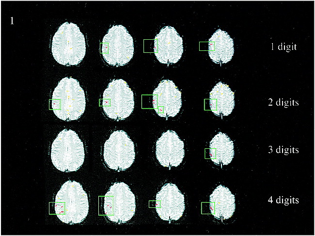 fig 1.